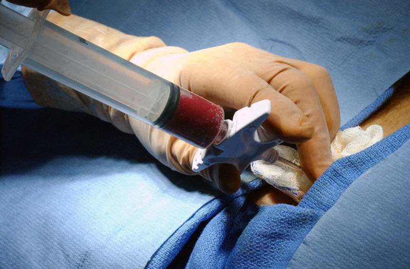 wikibonemarrowbiopsy.jpg