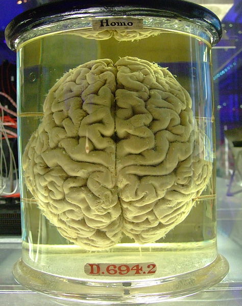 wikibraininvat.jpg