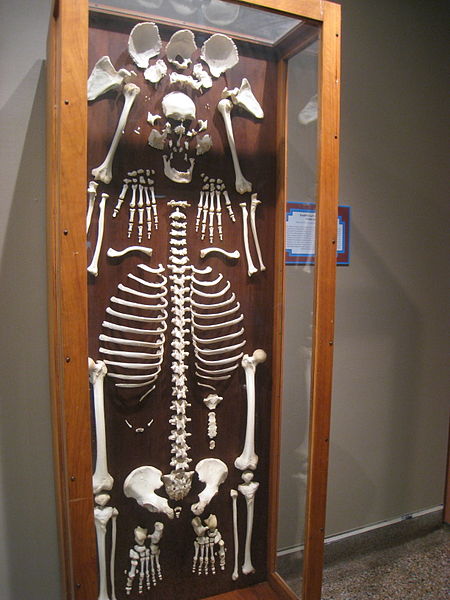 wikidisarticulatedhumanskeleton.JPG